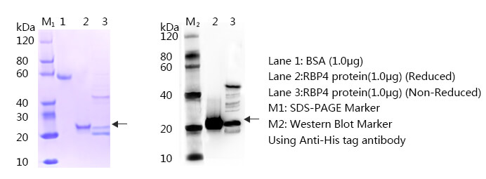 RBP4 SDS-PAGE western blot