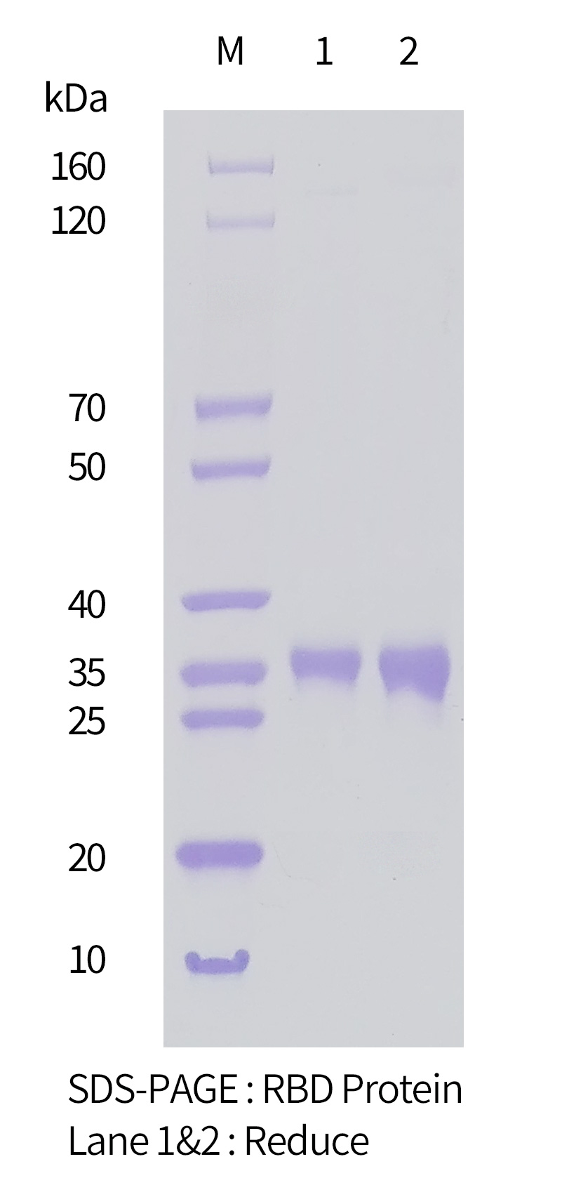 2019-nCoV抗體純化SDS-PAGE圖