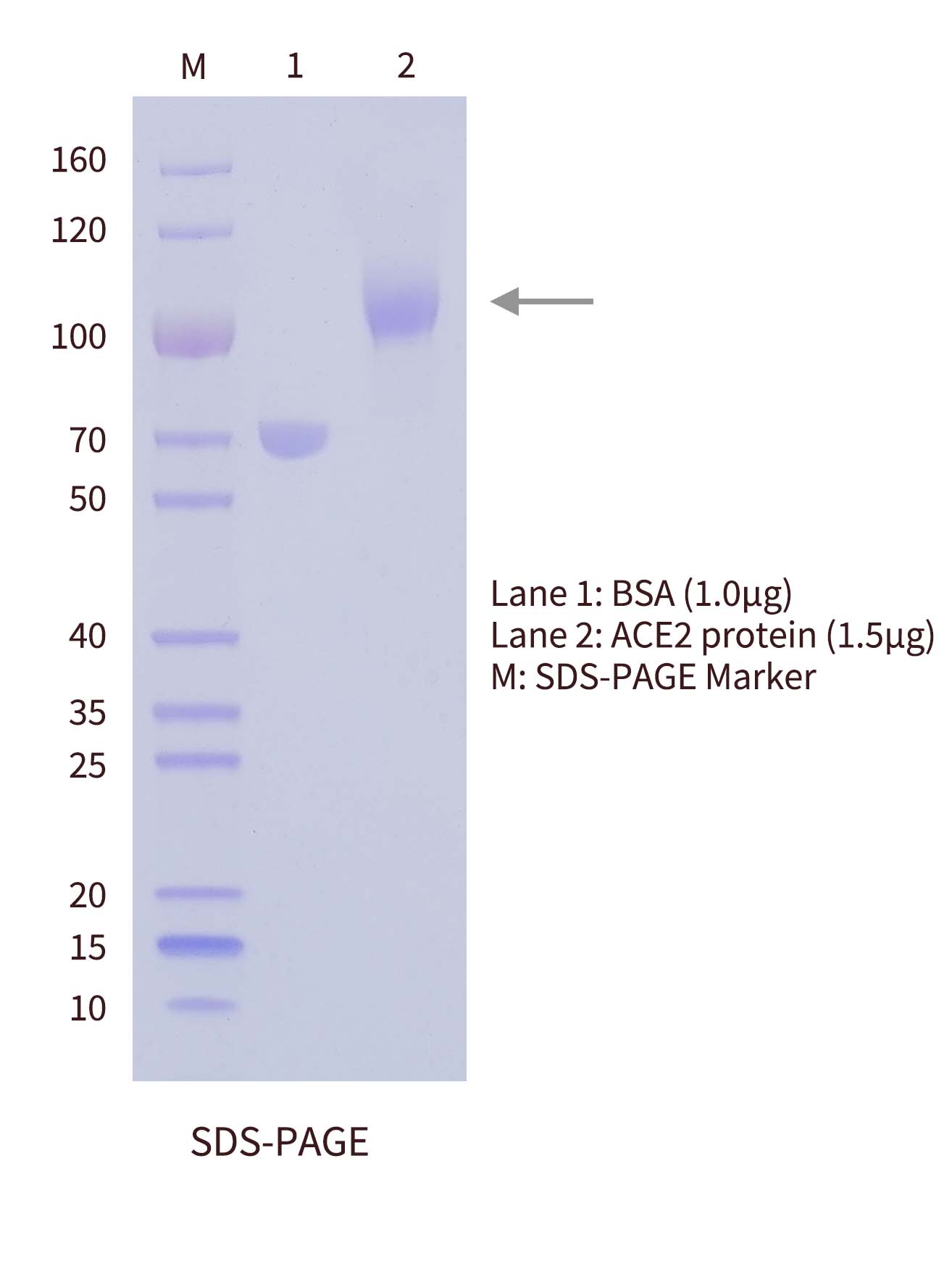 SDS-PAGE of ACE2 antigen SDS-PAGE of ACE2 antigen